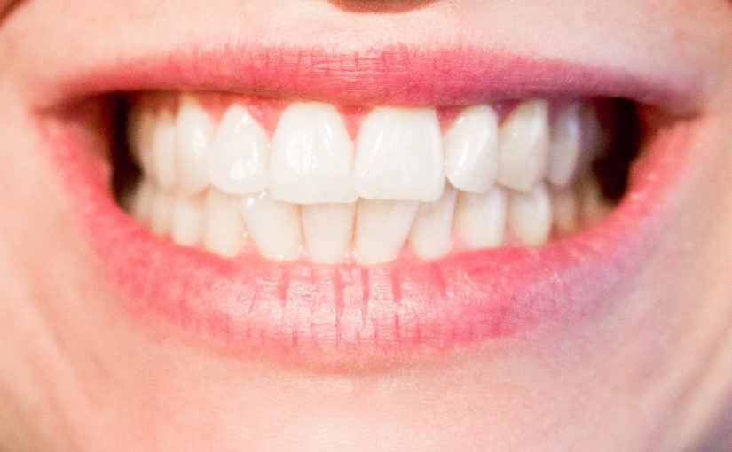 Dzisiejsza technika używana w salonach stomatologii estetycznej zdoła sprawić, że odzyskamy śliczny uśmiech.